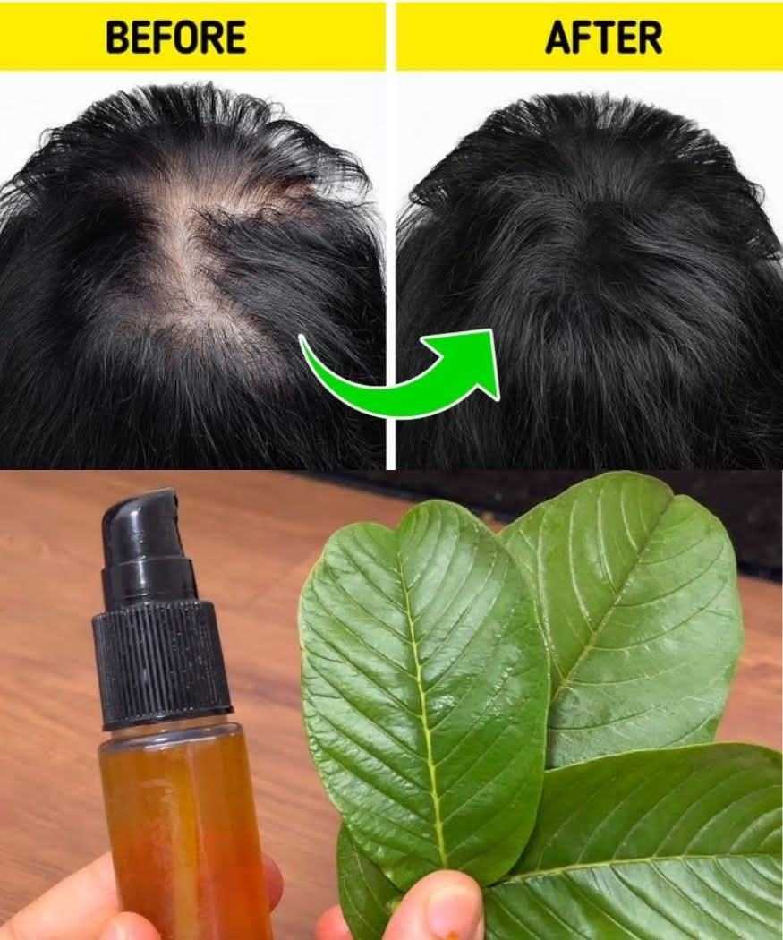 Put Guava Leaves in Your Shampoo and Watch Your Hair Grow Even on Your Forehead!Put Guava Leaves in Your Shampoo and Watch Your Hair Grow Even on Your Forehead!