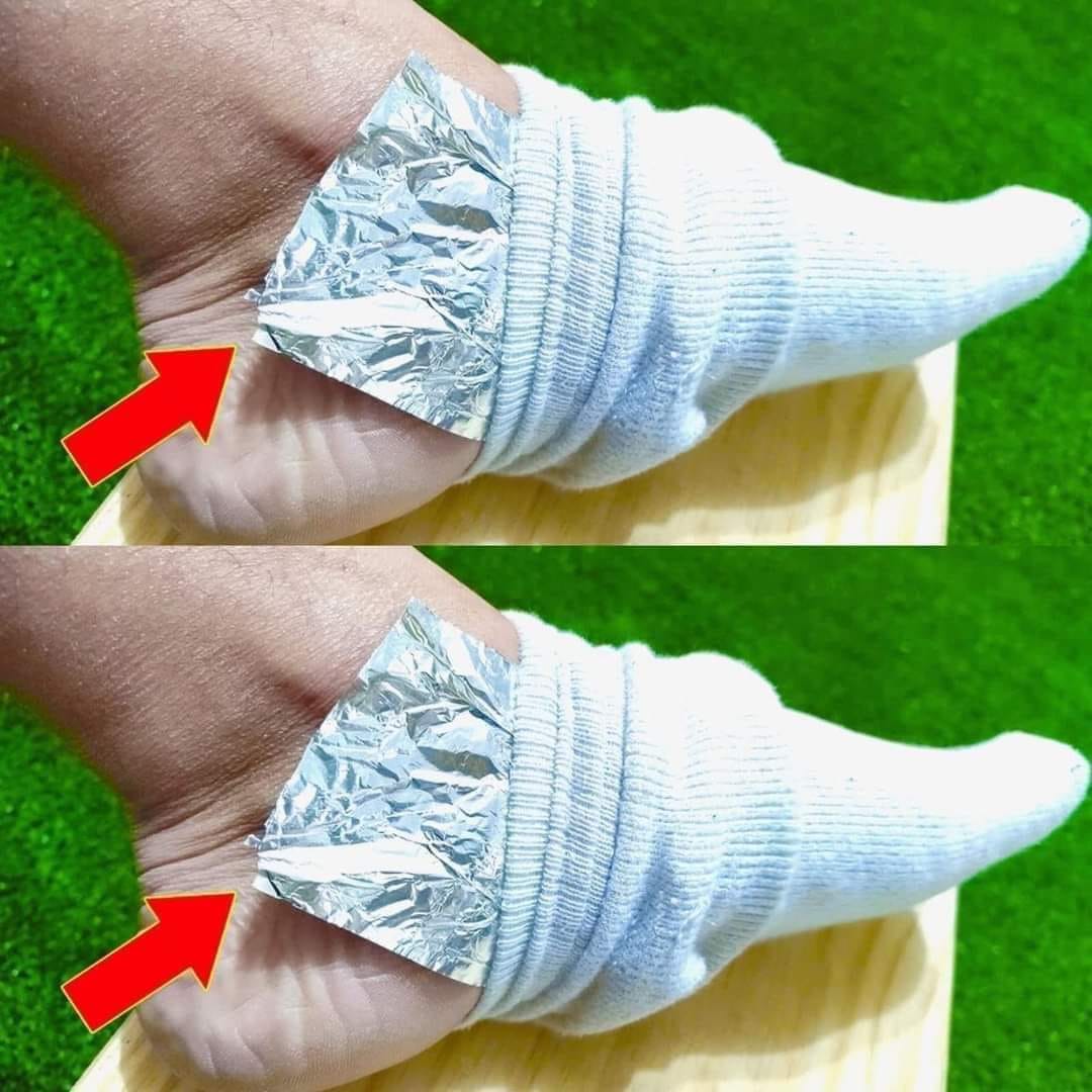 Put Aluminum Foil on Your Feet and Stop Spending Money at the Pharmacy: The Surprising Hack