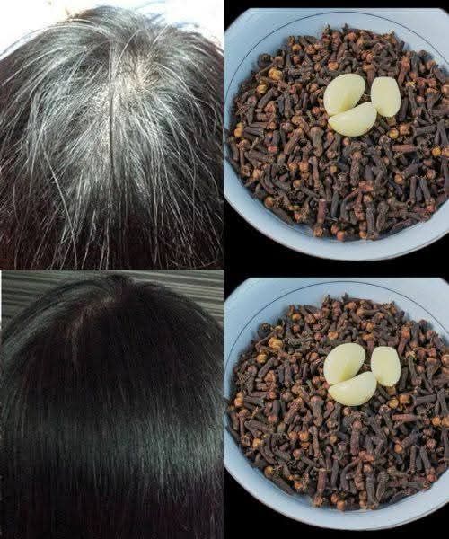 Reverse White Hair Naturally with Just Two Ingredients: Garlic and Clove
