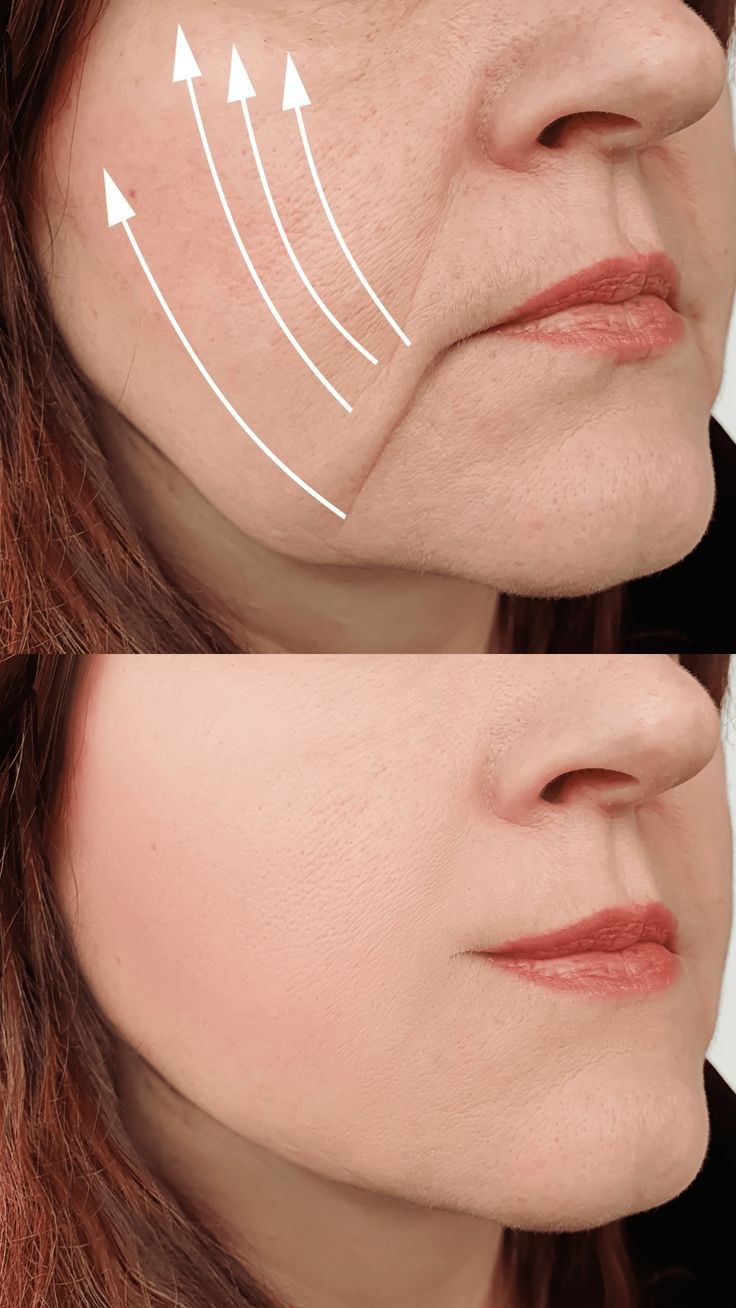 Without this 1 key mineral, your skin will more likely sag with age.