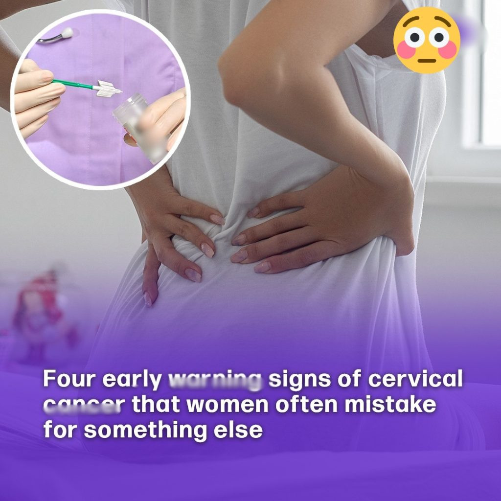 Four early war:ning signs of cervical canc3r that women often mistake for something else!