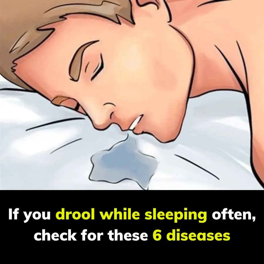 If You Drool While Sleeping Often, Check for These 6 Diseases