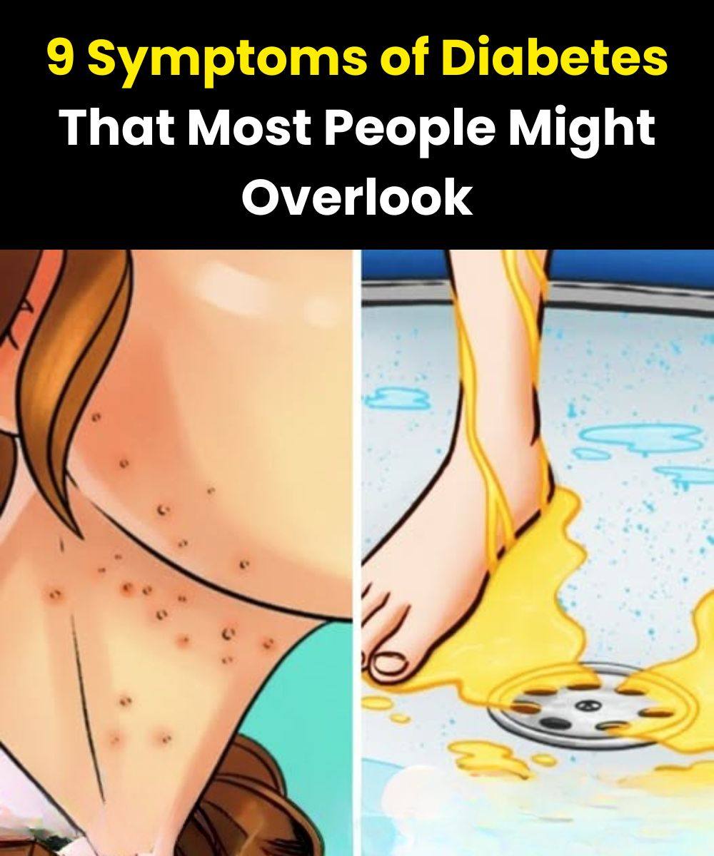 9 Symptoms of Diabetes That Most People Might Overlook When They’re Still Young