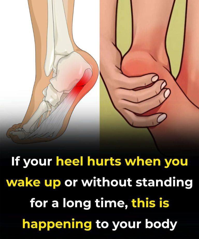 7 Powerful Exercises to Relieve Heel Pain and Treat Plantar Fasciitis Naturally